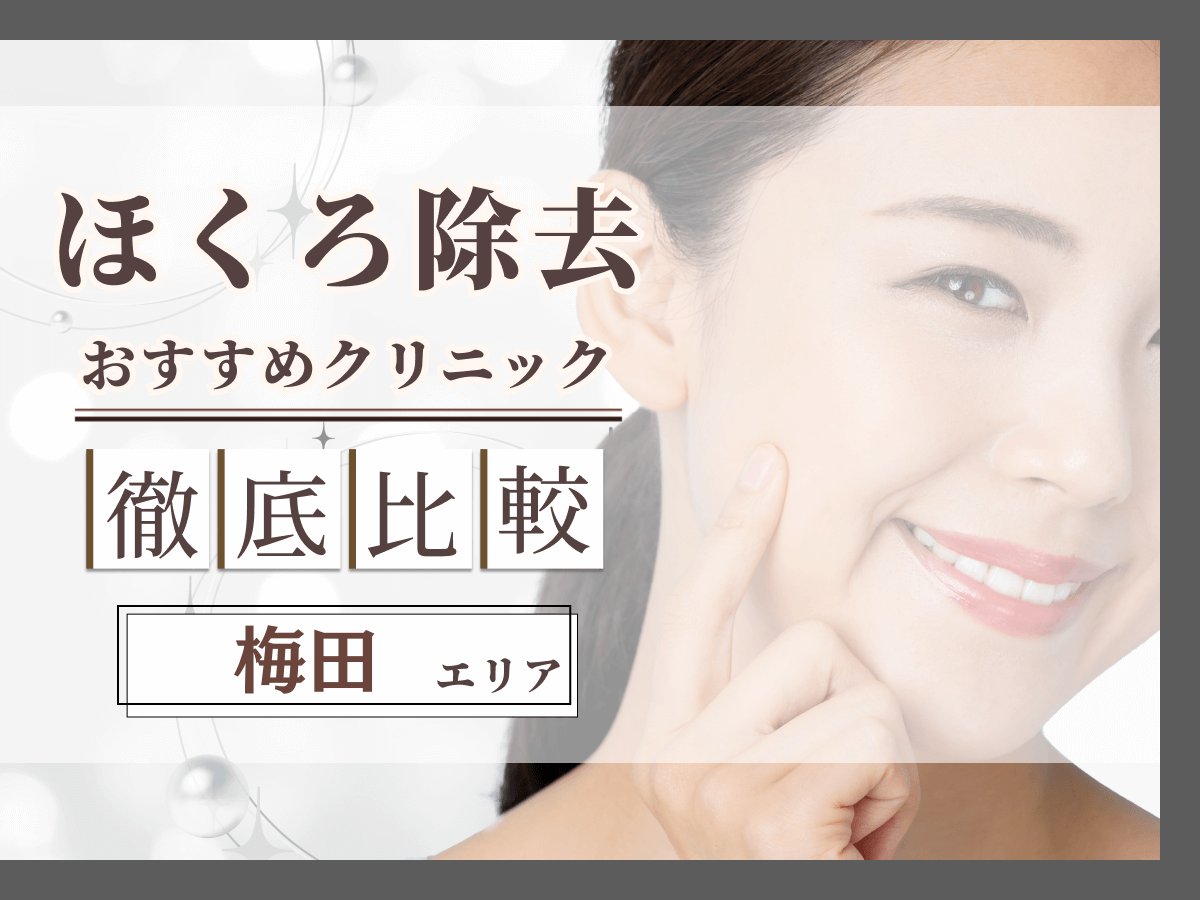 梅田でほくろ除去がおすすめクリニックは？評判のいい病院と値段目安まで紹介！