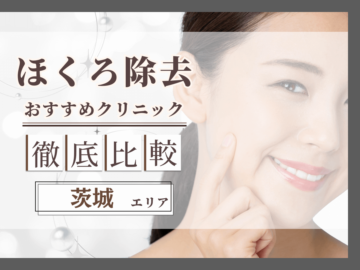 茨城でほくろ除去がおすすめクリニックは？評判のいい病院と値段目安まで紹介！